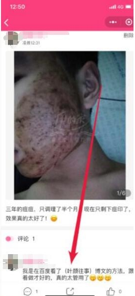 做护肤品的怎么引流,利用小程序获取精准流量(图6) 555.png